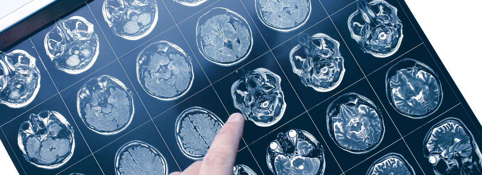 Neuro-Optometry in Simpsonville